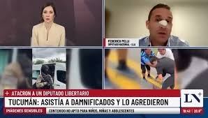 Federico Pelli relató el ataque en La Madrid: “Recibí un cabezazo y perdí la noción” Federico Pelli relató el ataque en La Madrid: “Recibí un cabezazo y perdí la noción”